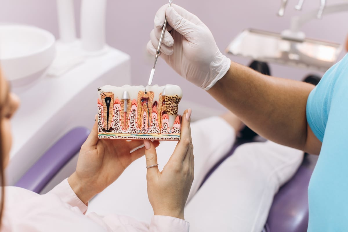Root Canal Treatment in Pittsburgh
